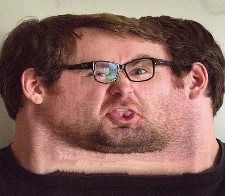 15