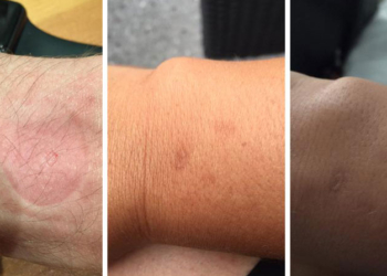Bazı Apple Watch kullanıcıları isilikten şikayetçi