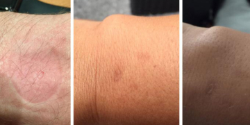 Bazı Apple Watch kullanıcıları isilikten şikayetçi