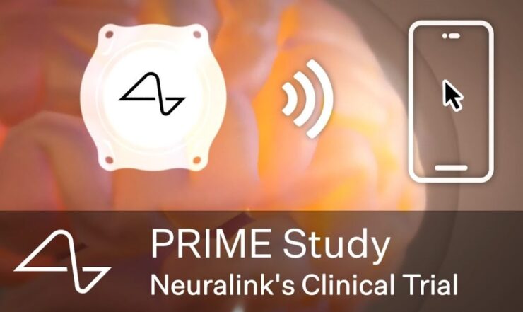 Neuralink 