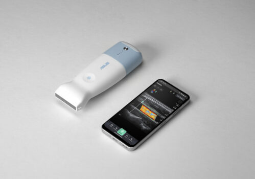 ASUS-Handheld-Ultrasound-LU800