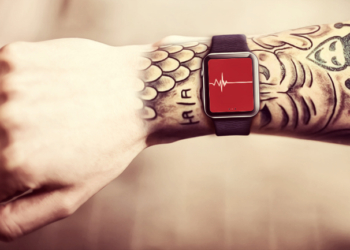apple watch dövme sorunu