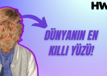dünyanın en kıllı yüzüne sahip insanı