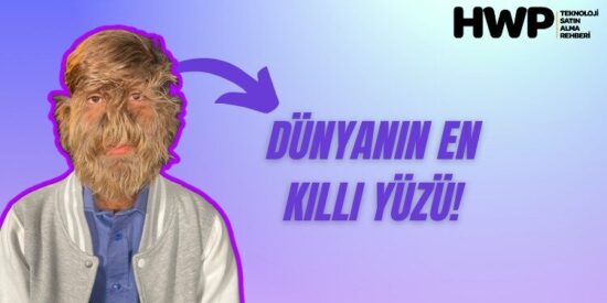 dünyanın en kıllı yüzüne sahip insanı